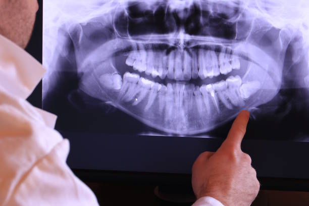 Best Broken or Chipped Tooth Repair in Conover, NC